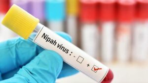 Nipah Virus Suspected in Barasat West Bengal
